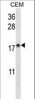 MGMT Antibody (aa1-30)