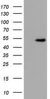 UHMK1 / KIS Antibody (clone OTI2D3)