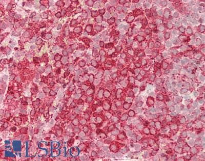 IHC-plus™ Monoclonal Mouse anti-Human HAX-1 Antibody (clone 9G6C6, IHC, WB)