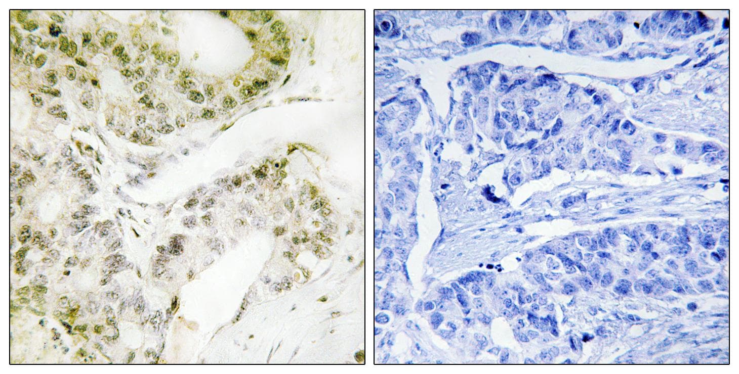 MED13 / TRAP240 Antibody