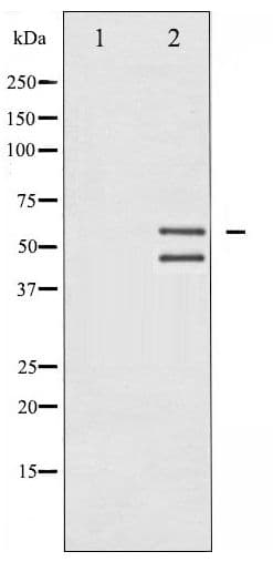 Polyclonal Rabbit anti-Human JNK1+2+3 Antibody (phospho-Thr183/Tyr185, WB)