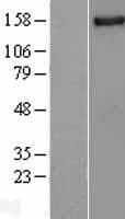 NUP155 Protein (Over-Expression Lysate Myc-DDK (Flag))
