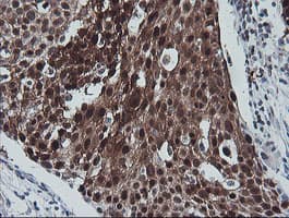 Monoclonal Mouse anti-Human CMPK / CMPK1 Antibody (clone OTI2B2, IHC, IF, WB)