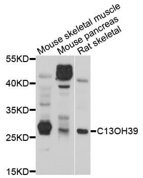 Polyclonal Rabbit anti-Human C13orf39 Antibody (WB)