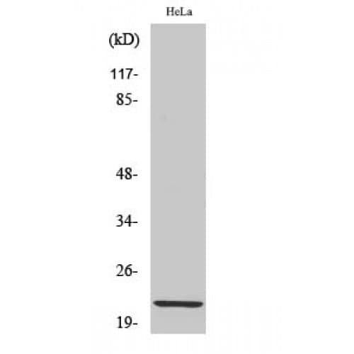 Polyclonal Rabbit anti-Human CLDN1 / Claudin 1 Antibody (140-220 aa, C-terminal, IHC, IF, WB)