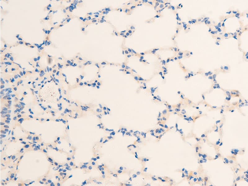HSPB6 / HSP20 Antibody (phospho-Ser16)