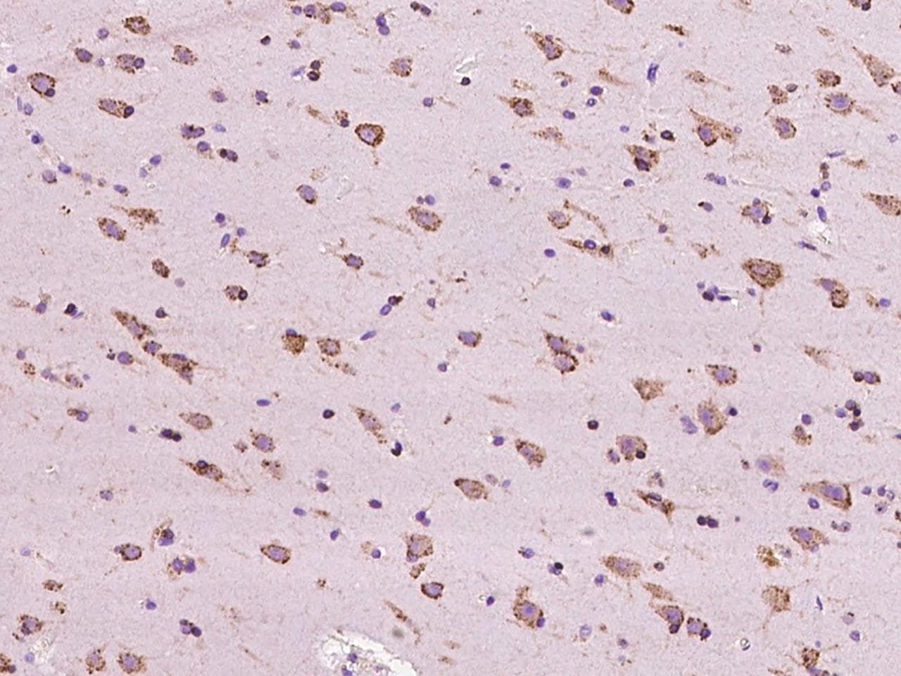 RAB5IF Antibody