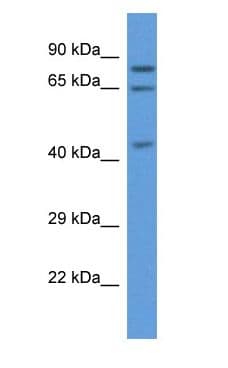 Polyclonal Rabbit anti-Human ACOX3 Antibody (aa412-461, WB)