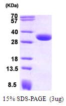 Human CBR / CBR1 Protein (Recombinant)