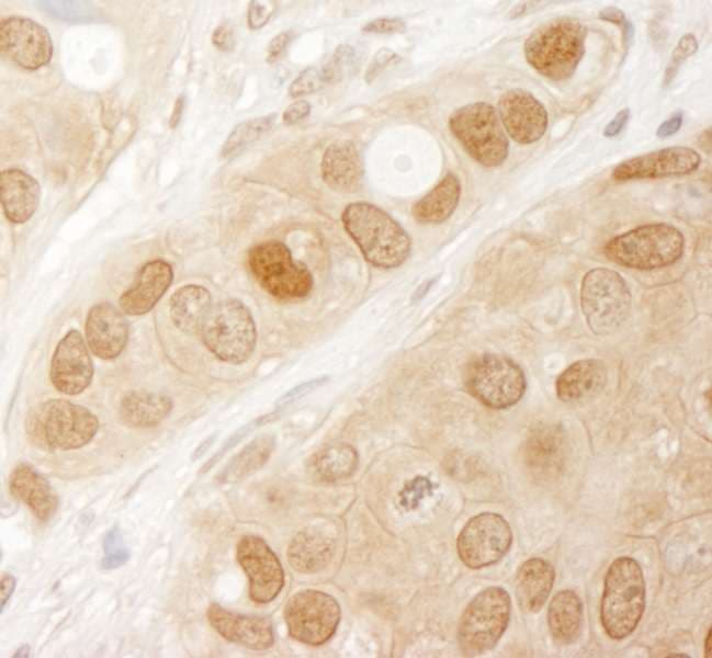 AKT1 Antibody (aa25-75)