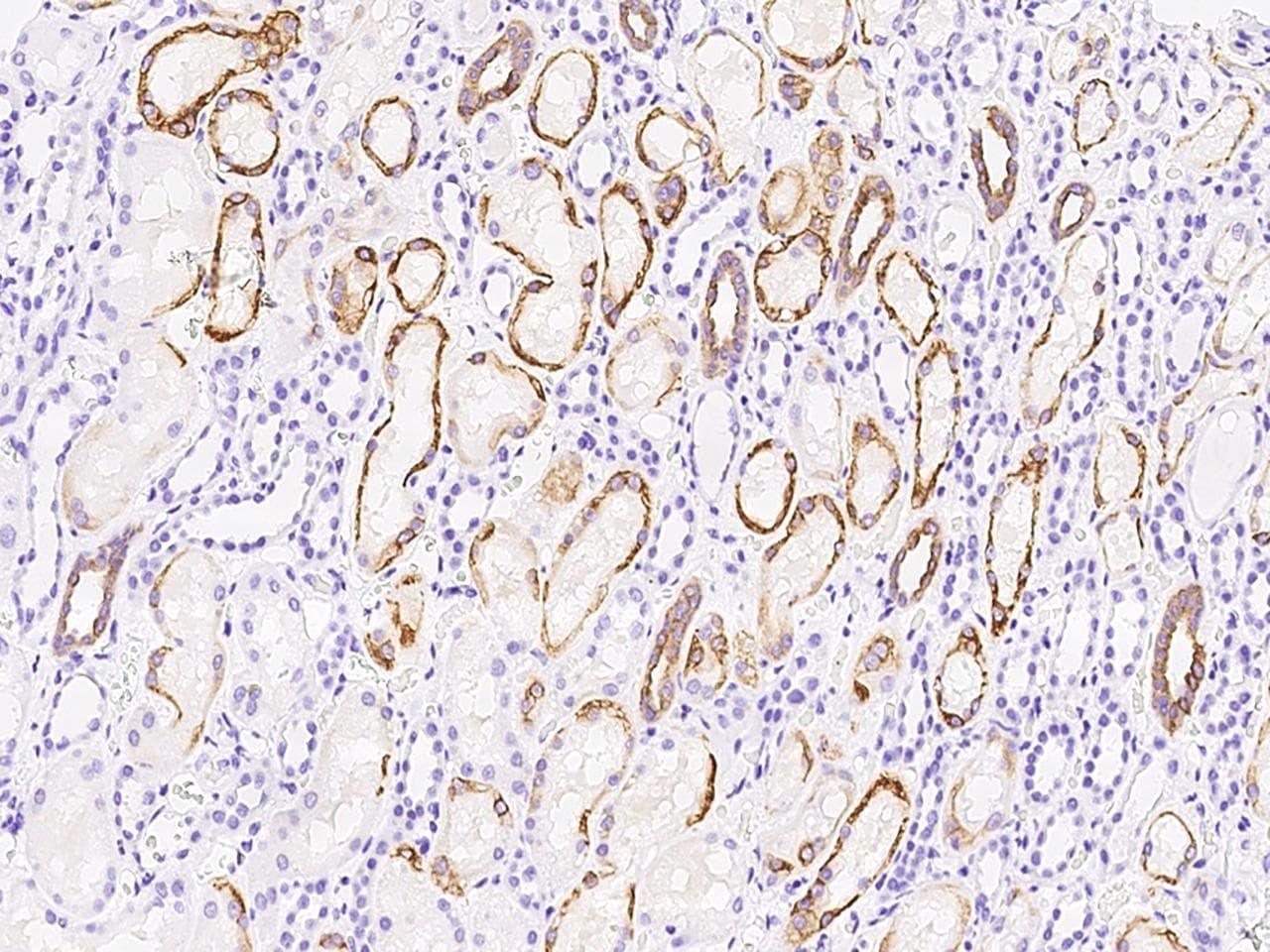 GORAB / SCYL1BP1 Antibody