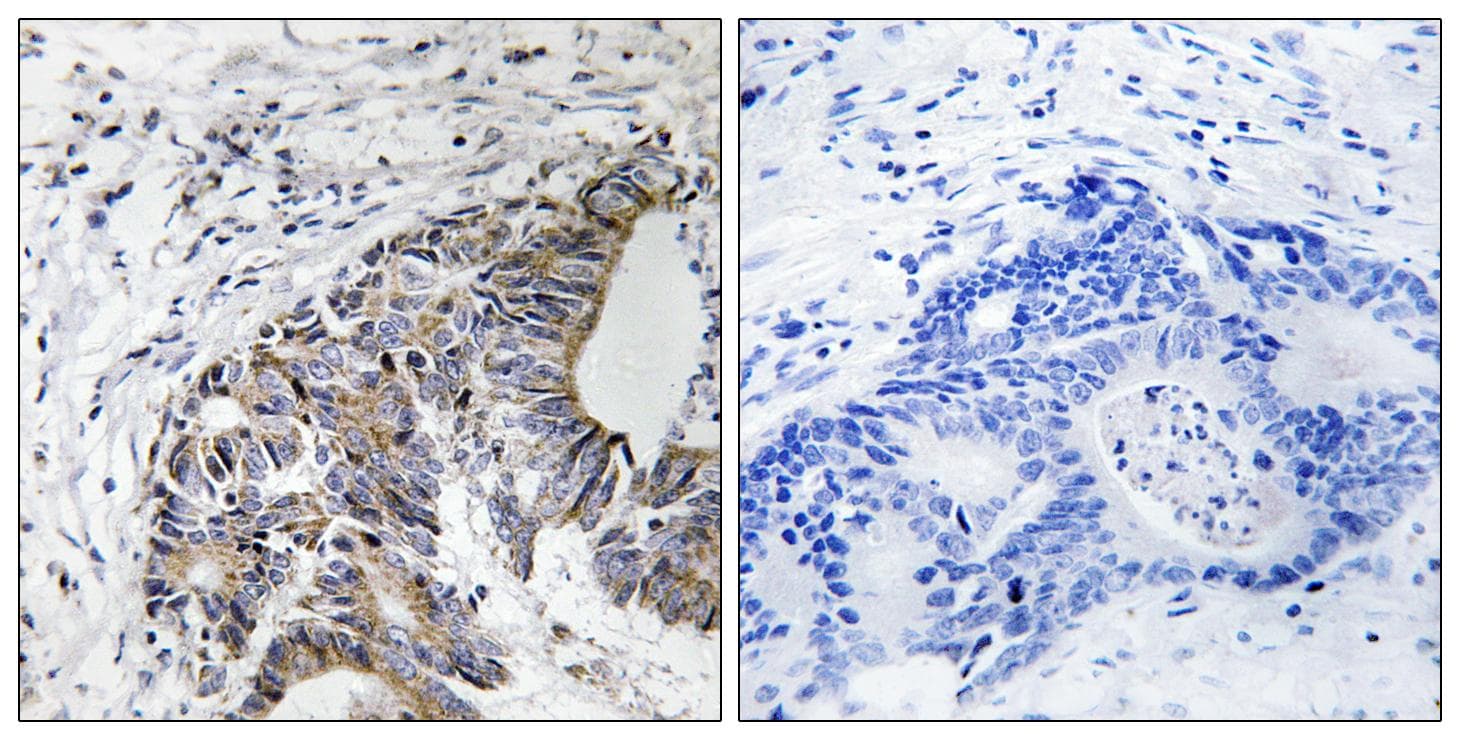 FHIT Antibody (phospho-Tyr114)