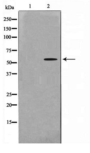 YTHDF1 Antibody