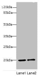 IHC-plus™ Polyclonal Rabbit anti-Human COXIV / COX4 Antibody (aa23-169, IHC, WB)
