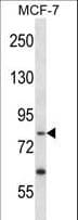 Polyclonal Rabbit anti-Human PRKRIR Antibody (aa102-130, WB)