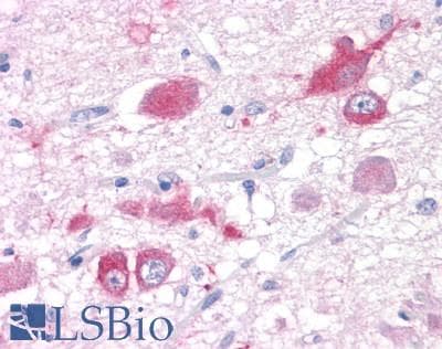 PathPlus™ GRM5 / MGLUR5 Antibody (C-Terminus)