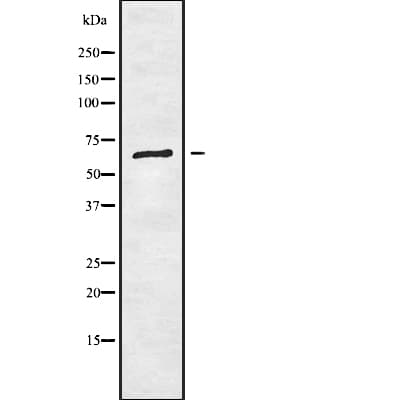 RIOK1 Antibody