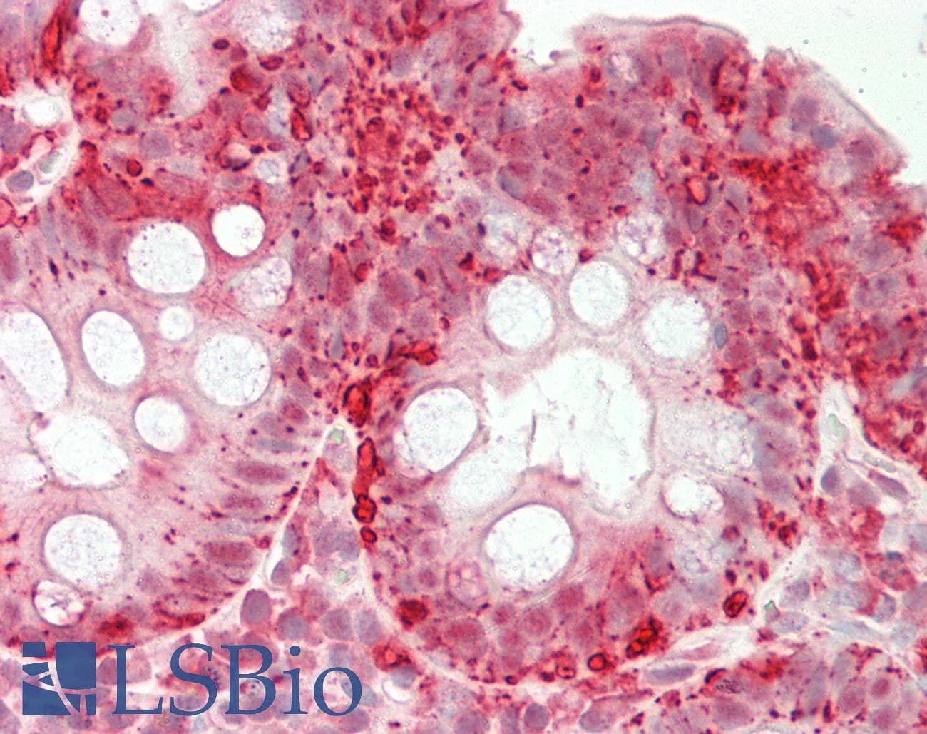 Polyclonal Rabbit anti-Human RBFOX1 / A2BP1 Antibody (C-Terminus, IHC, WB)