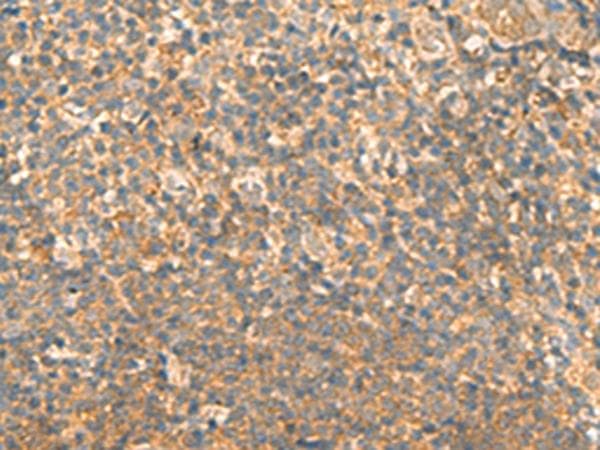 EMC1 Antibody