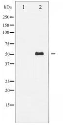 TP53 / p53 Antibody