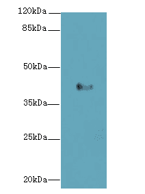 LPAR4 / GPR23 Antibody