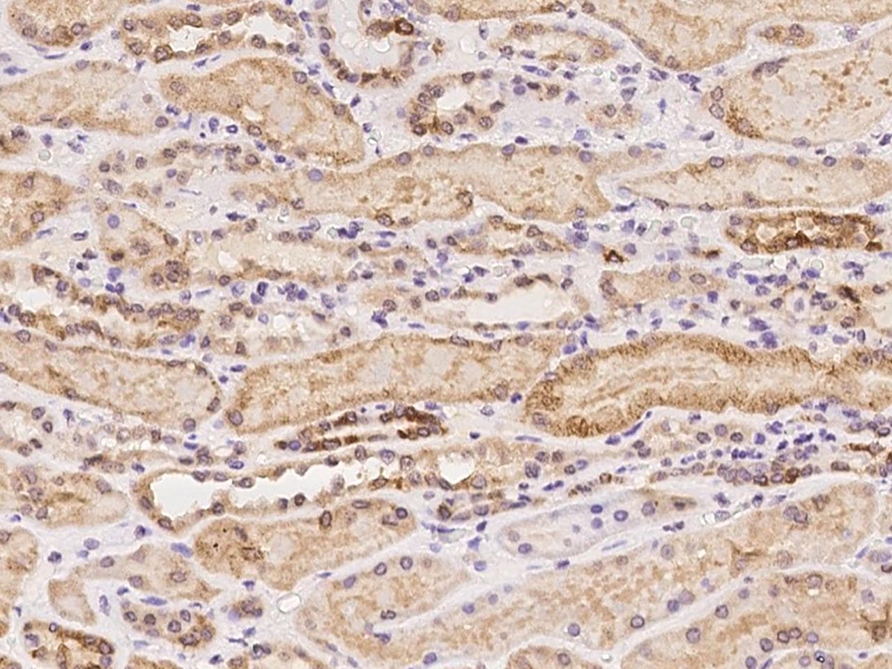 C5orf22 Antibody