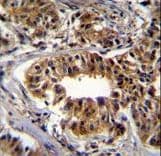 Polyclonal Rabbit anti-Human CAD Antibody (aa780-809, IHC, WB)