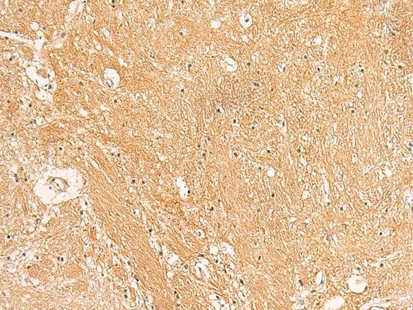 Polyclonal Rabbit anti-Human TXNDC12 Antibody (IHC)