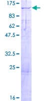 Human KIF3C Protein (Recombinant GST)