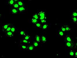 PDX1 Antibody (clone OTI2A12)