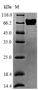 Peanut Allergen Ara h 1 Protein (Recombinant 6His, N-terminus)