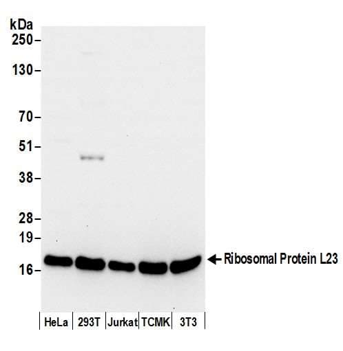 RPL23 / Ribosomal Protein L23 Antibody (aa50-100)