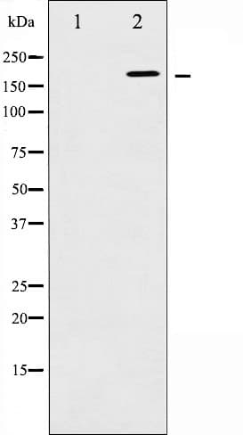 WNK1 Antibody (phospho-Thr58)