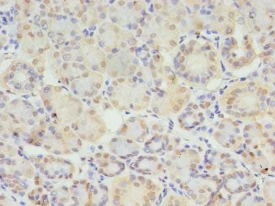 STX10 / Syntaxin 10 Antibody