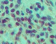 CLEC6A / Dectin 2 Antibody (aa75-125, clone IMG3D1)