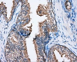 BTK Antibody (clone OTI3A2)