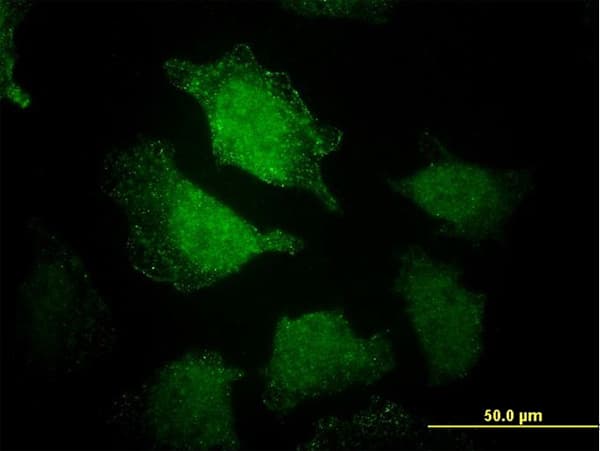 Monoclonal Mouse anti-Human EHD3 Antibody (clone 4B7, IHC, IF, WB)