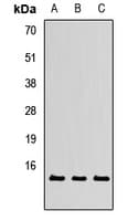 Polyclonal Rabbit anti-Human TXNL4A Antibody (WB)