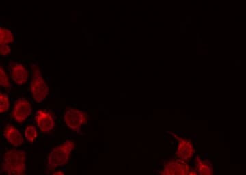 BTC / Betacellulin Antibody