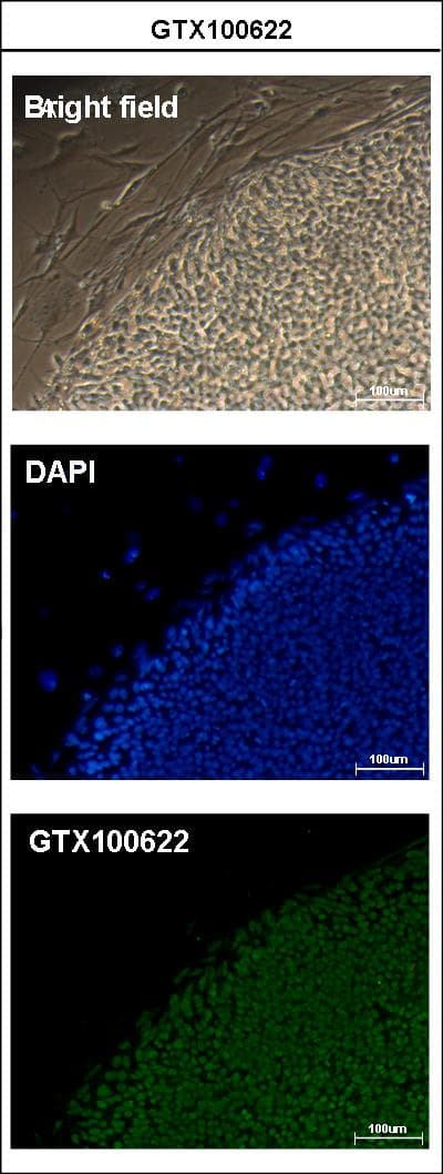 IHC-plus™ Polyclonal Rabbit anti-Human POU5F1 / OCT4 Antibody (IHC, IF, WB)