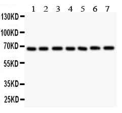 Polyclonal Rabbit anti-Human GAD1 / GAD67 Antibody (aa10-24, IHC, WB)