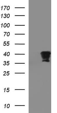 Monoclonal Mouse anti-Human FNDC8 Antibody (clone OTI1C12, IHC, WB)
