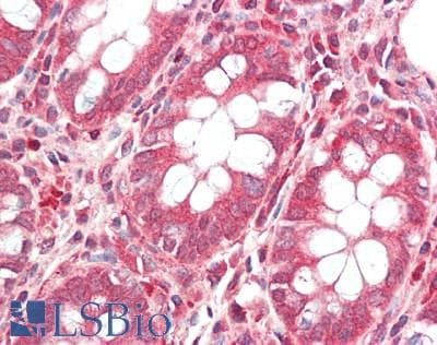TIAL1 Antibody (aa275-325)