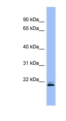 Polyclonal Rabbit anti-Human RHEB Antibody (aa107-156, IHC, WB)