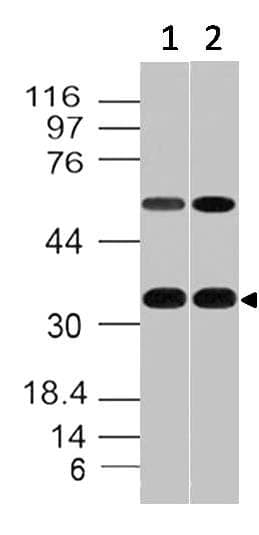 CD20 Antibody