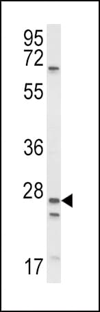 Polyclonal Rabbit anti-Human SCNN1A / ENaC Alpha Antibody (aa365-391, IHC, IF, WB)