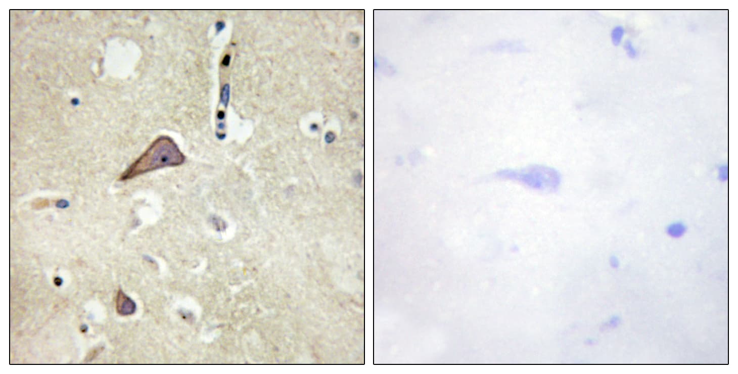 GRIN1 / NMDAR1 Antibody (phospho-Ser896)