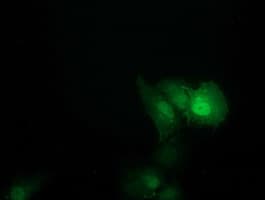Monoclonal Mouse anti-Human SOCS3 Antibody (clone OTI6C12, IF, WB)
