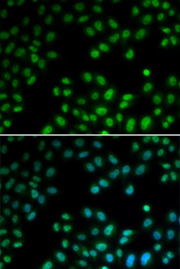 PIAS1 Antibody