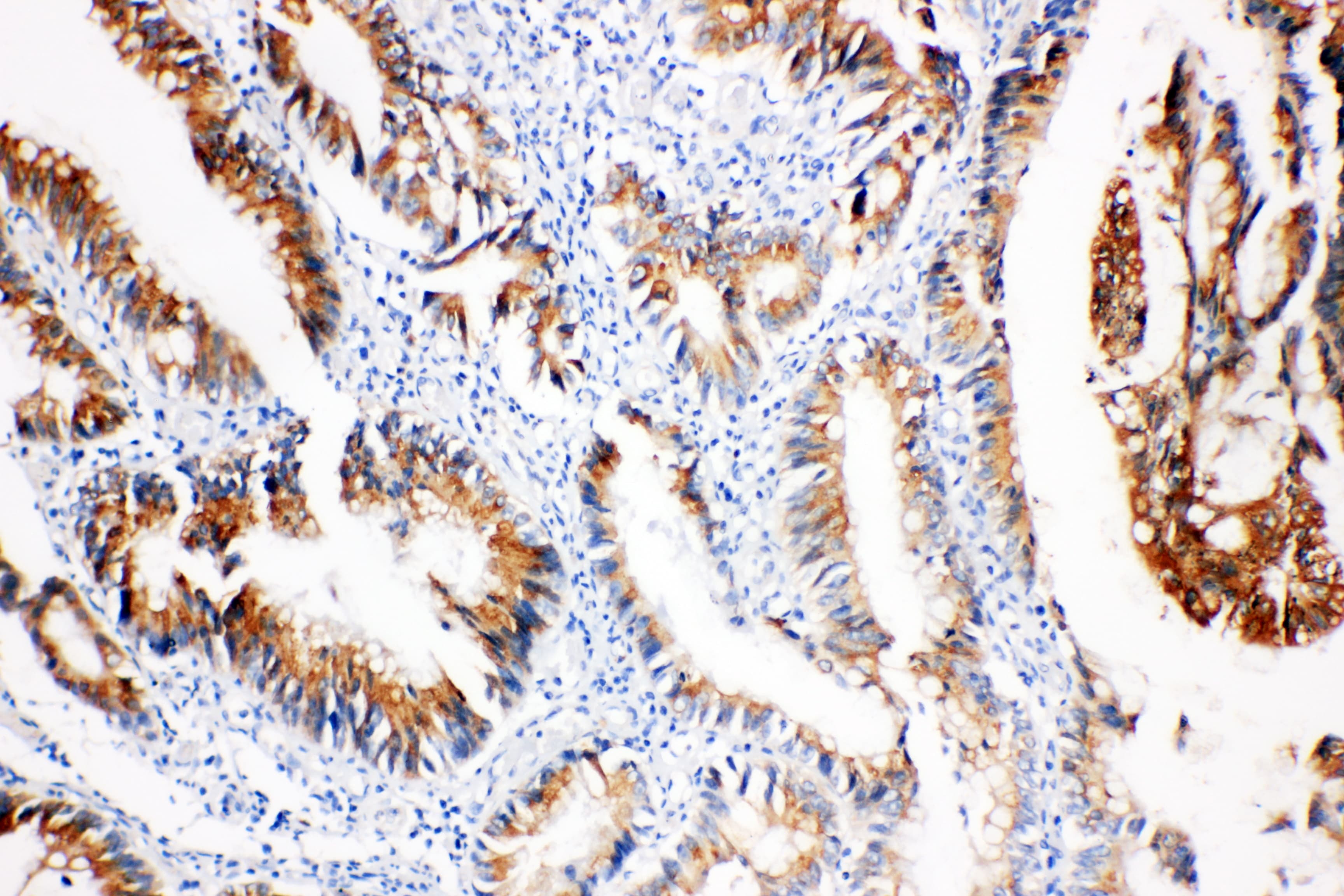 Polyclonal Rabbit anti-Human PTGS2 / COX2 / COX-2 Antibody (aa589-604, IHC, WB)